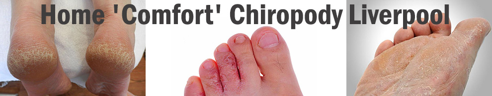 Home Comfort Chiropody Liverpool - Our Services